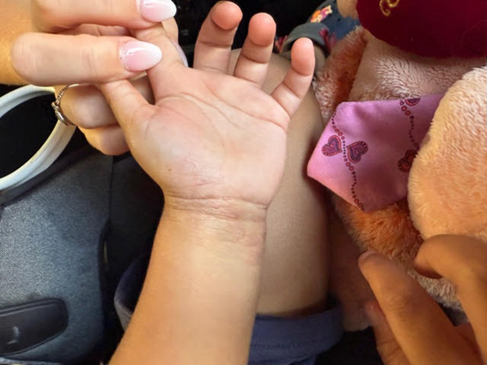 Sensitive Skin Healing After Surgery Made Simple